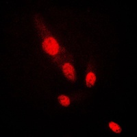 AKT2 antibody