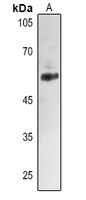 ALDH2 Antibody