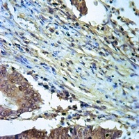 Anti-ALDH2 Antibody