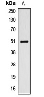 ALDH3A1 Antibody