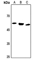 ALDH1B1 Antibody