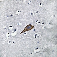 Anti-CD13 Antibody