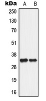 ANT2 Rabbit Polyclonal Antibody