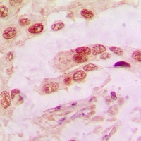 Anti-Annexin A1 Antibody