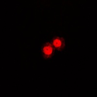 Anti-Annexin A1 Antibody