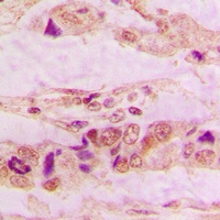 Anti-Annexin A3 Antibody