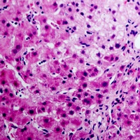 Anti-Annexin A6 Antibody