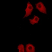 Anti-Annexin A6 Antibody