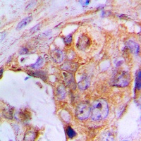 Anti-APAF-1-ALT Antibody
