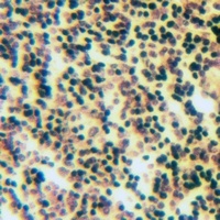 Anti-Apolipoprotein F Antibody