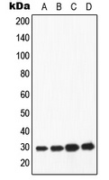 Apolipoprotein A1 Rabbit Polyclonal Antibody