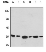 Apolipoprotein E Antibody