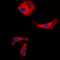 Anti-Kallikrein 3 Antibody