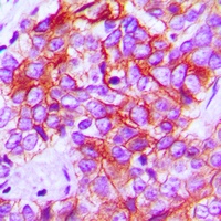 CD95 Antibody