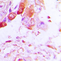 Anti-Aquaporin 5 Antibody