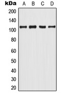 Androgen Receptor (Phospho-Y363) Antibody