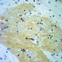 Anti-A-RAF (Phospho-Y302) Antibody