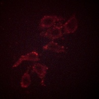 Anti-A-RAF (Phospho-Y302) Antibody