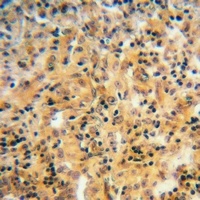 Anti-ARF6 Antibody
