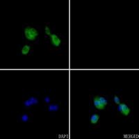 Anti-ARF6 Antibody