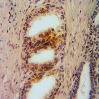 Anti-Arginase 2 Antibody