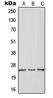 RhoGDI gamma Rabbit Polyclonal Antibody