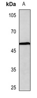 Beta-arrestin-1 (Phospho-S412) Antibody