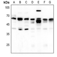 Arylsulfatase A Antibody