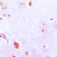 Arylsulfatase A Antibody