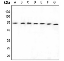 Arylsulfatase E Antibody