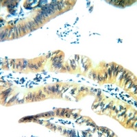 Anti-Arylsulfatase E Antibody