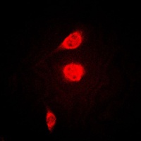 Anti-ATF1 Antibody