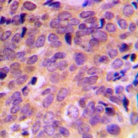 Anti-ATF4 Antibody