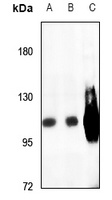 SERCA1 Rabbit Polyclonal Antibody