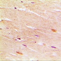 Anti-SERCA1 Antibody