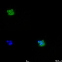 Anti-SERCA1 Antibody