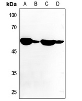 ATP6V1B1 Antibody