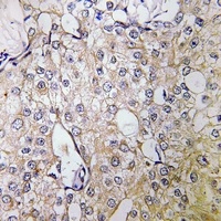 Anti-ATP6V1B1 Antibody