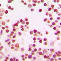 Anti-BACH1 Antibody