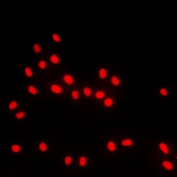 Anti-BACH1 Antibody