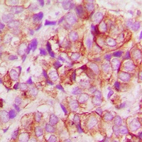 Anti-BAX Antibody
