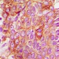 Anti-BAX Antibody