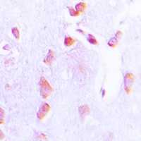 BCL2 (phospho-T69) antibody