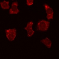 Anti-BCL2 (Phospho-T69) Antibody