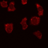 BCL2 (phospho-T69) antibody