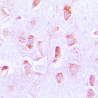BCL2 Antibody