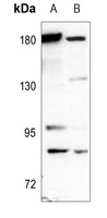 CD66a/e Antibody