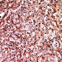 CD66a/e Antibody
