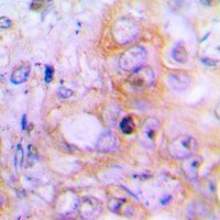 Anti-BMP2 Antibody