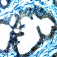 Anti-BMP3A Antibody